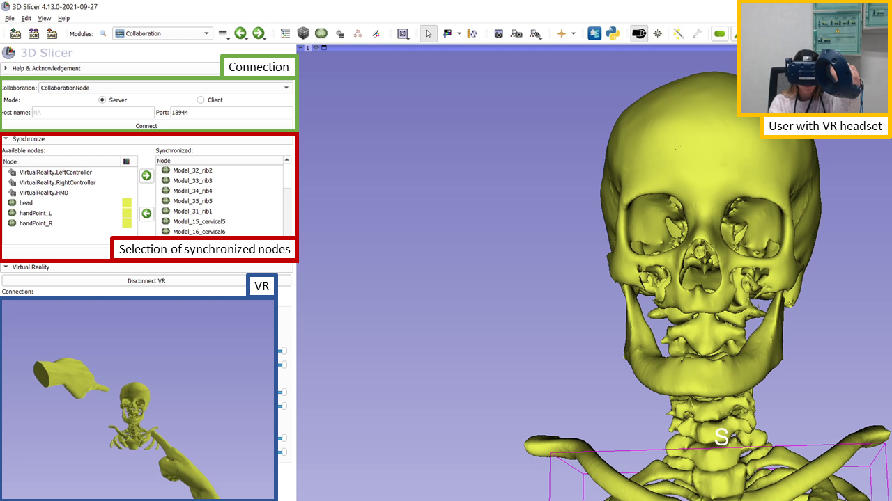 SlicerCollaboration screenshot VR